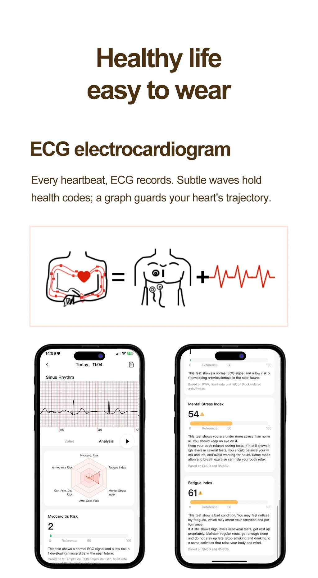 Women ECG Health Smart Watch 1.32'' AMOLED